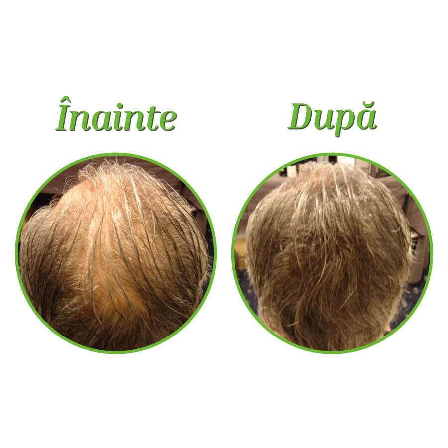 Fibre di cheratina naturale per densificare i capelli, Satinato leggero, 25 g, TCR
