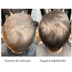 Kit contre la chute des cheveux, Ageless Clinic, 3 pièces, Ru:t hair, 80 ml, Biocart