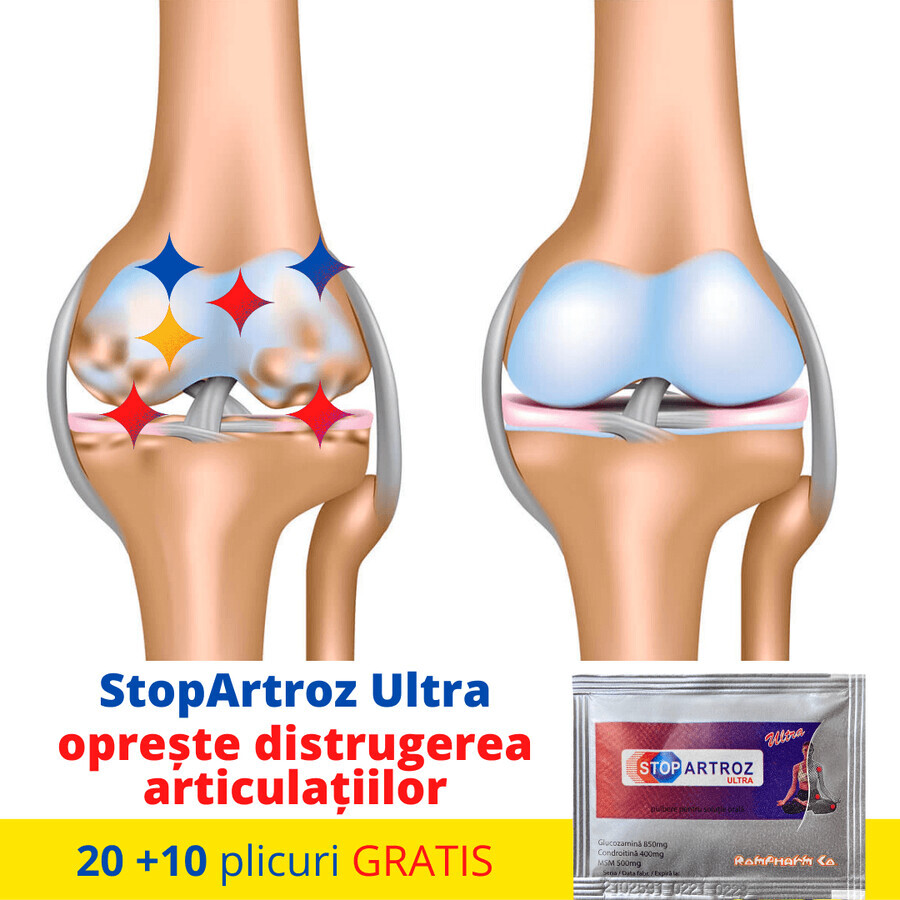 Stopartrosi Ultra, 30 bustine, Rompharm