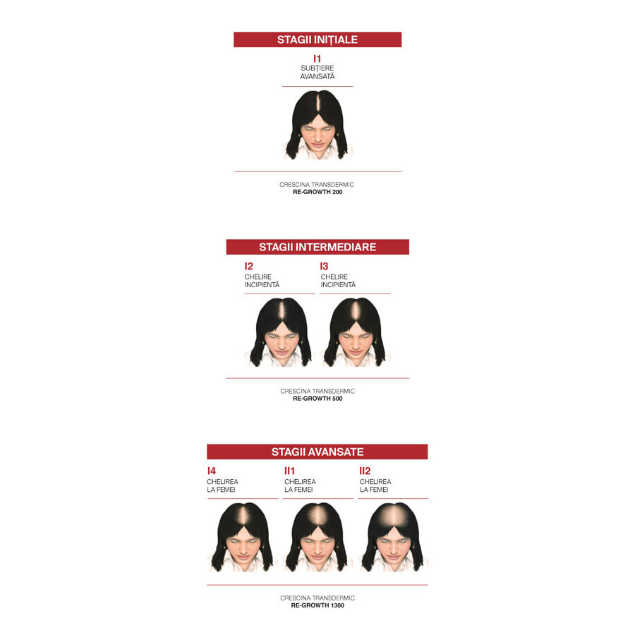 Vollständige Behandlung für die frühen Stadien des Haarausfalls und dünner werdendes Haar bei Frauen Crescina Follicular Islands 1700, 10 + 10 Ampullen, Labo