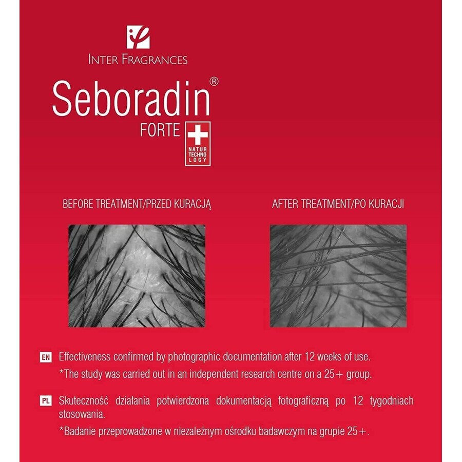 Seboradin Forte, tratament împotriva căderii părului, 5.5 ml x 14 fiole