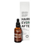 Veoli Botanica Hairly Ever After, loción de aceite estimulante, fortalecedora y regeneradora para el cuero cabelludo, 50 ml