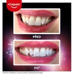 Colgate Max White Ultra Multiprotect Whitening Toothpaste 50 ml