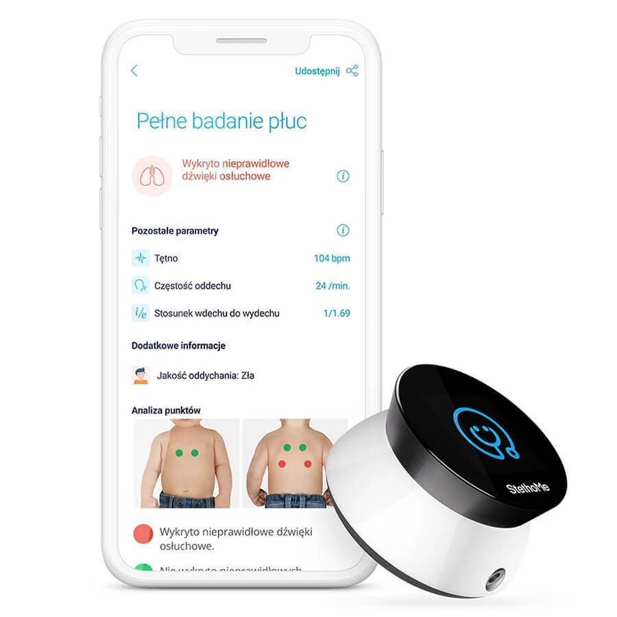 StethoMe, le stéthoscope intelligent pour toute la famille