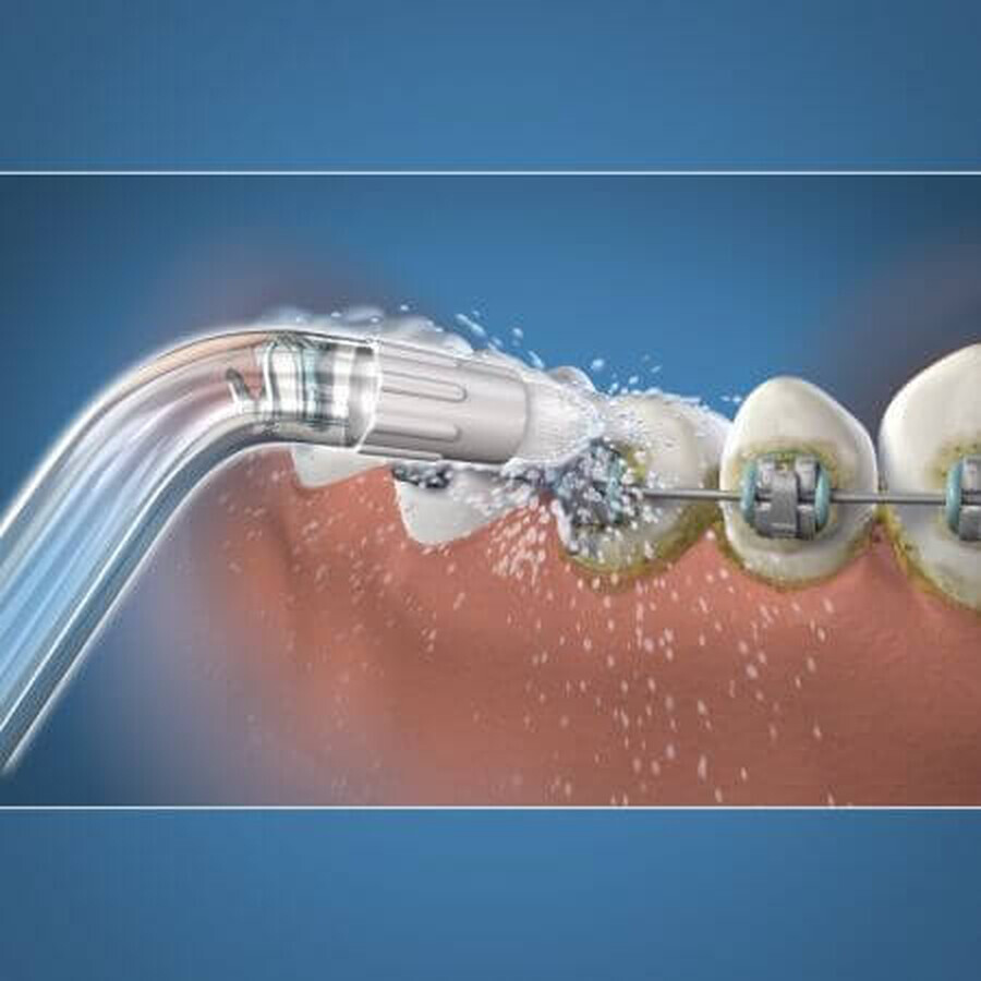 Capete ortodontice pentru dușul bucal, 2 bucăți, OD-100, Waterpik