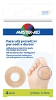 PROTECȚII PENTRU NODURI PENTRU ÎNGRIJIREA PICIOARELOR-DURO4P