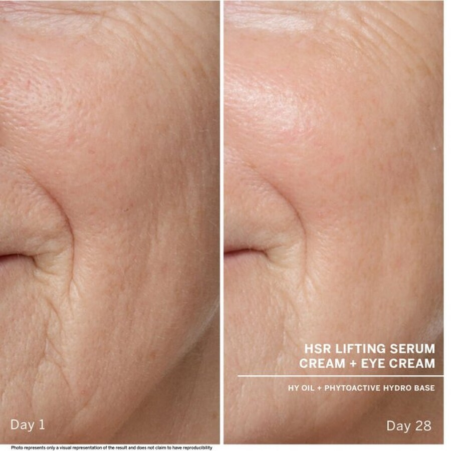Babor HSR Lifting Anti-Wrinkle Serum 30ml